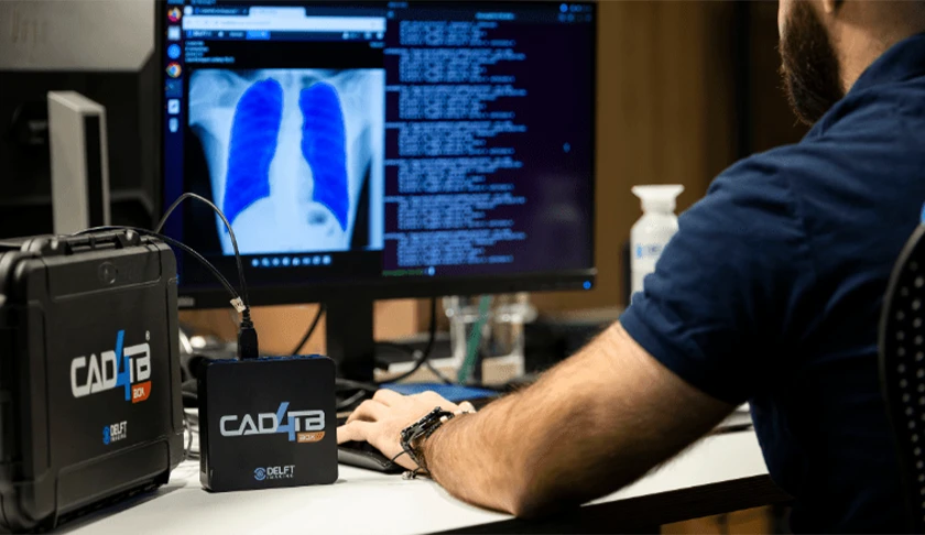 delft-imaging-cad4tb